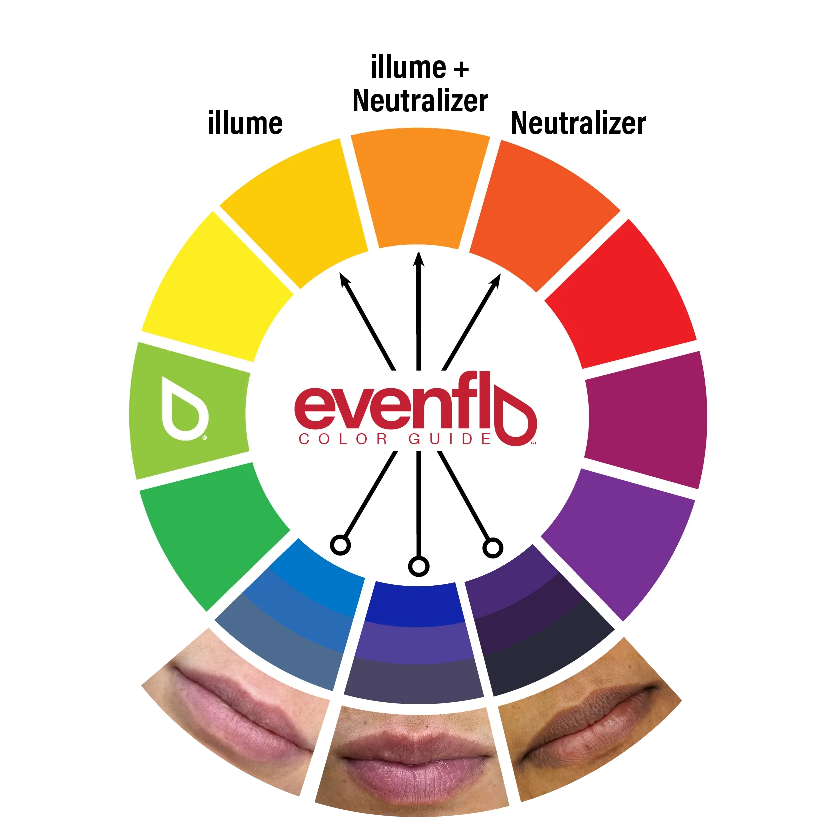 Evenflo Neutralizer Set — 3 1/2oz Bottles - Ultimate Beauty