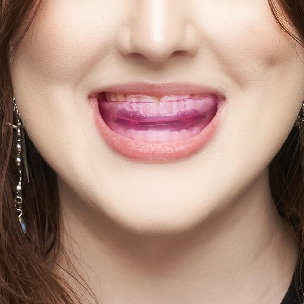 Ultimate Beauty Lip Assist — Pink - Ultimate Beauty